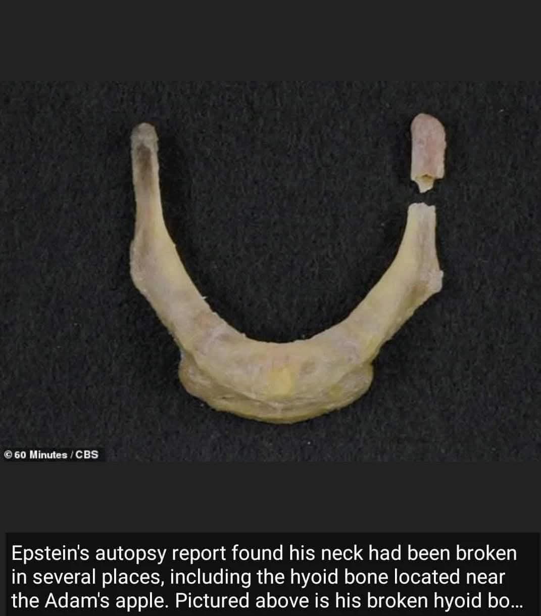 Hyoid bone image