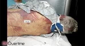 Additional autopsy documentation 1