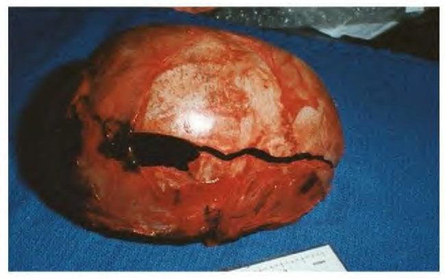 JonBenét Ramsey Archive 24